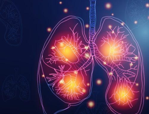 COVID e conseguenti lesioni pleuriche
